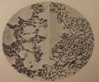 TULISOC-Logo: Historical picture of Francisella tularensis 