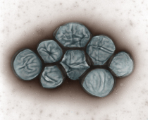 Francisella tularensis:  Negativkontrastierung im Transmissionselektronenmikroskop (TEM), Primärvergrößerung x 16.000 © Schlier, Gelderblom (Colouring: Schnartendorff) / RKI